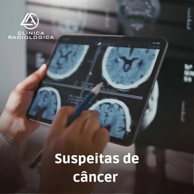 Os exames de raio X são de extrema importância na medicina. A partir deles é possível oferecer diagnósticos cada vez mais precisos para prob