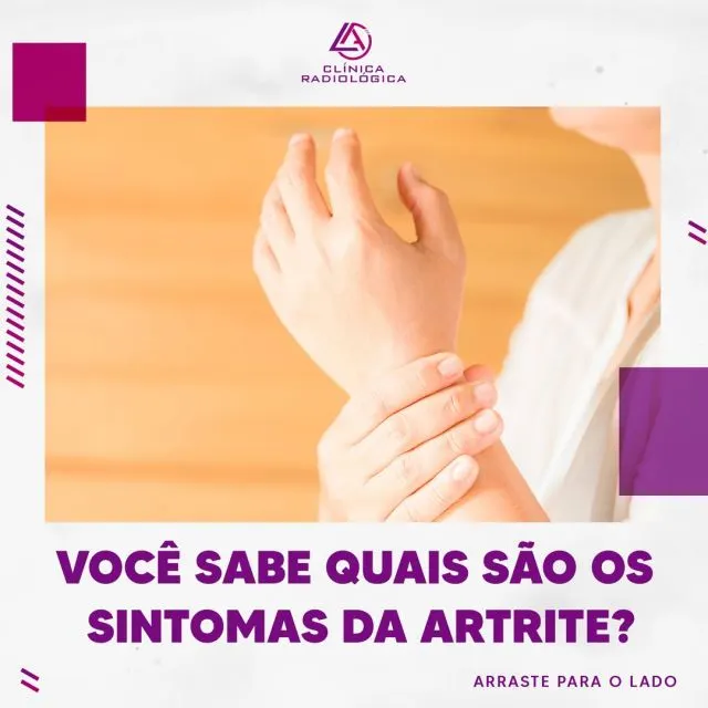 A artrite é uma doença crônica caracterizada pela inflamação das articulações, podendo ser causada por traumatismo, excesso de peso, poluiçã
