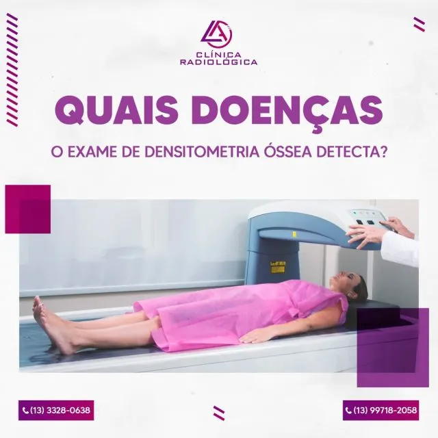 Com o avanço da idade, é comum o corpo passar por alterações que demandem maior cuidado e atenção. Doenças como a osteoporose (perda progres